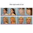 thumbnail image 2 of BEMS-Mini máquina de estiramiento facial con microcorriente, estiramiento de arrugas faciales, 2 of 3