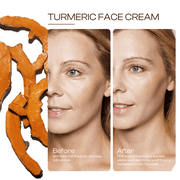 Turmeric Face Cream with Vitamin C –Fades Dark Spots & Hydrates Dry & Oily Skin