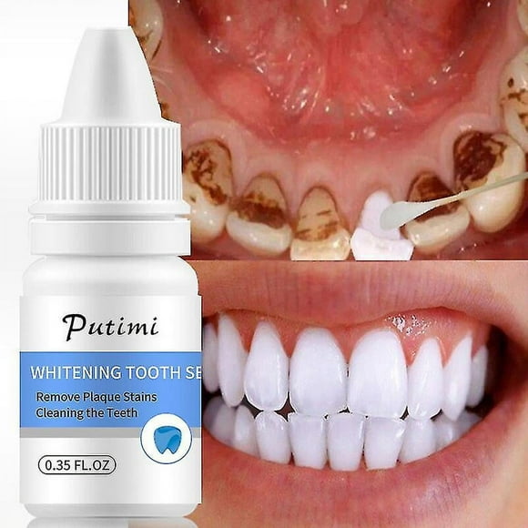 Teeth Whitening Serum Oral Hygiene Whitening Gel Removes Plaque Stains Cleaning Bleaching Tooth Whitening