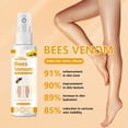 thumbnail image 2 of Varicose Veins Spray, Varicose Veins For Removing Varicose Veins, Spider Veins Removal Spray, Spider Veins Spray, Varicose Veins Spray To Leg Pain 30ml, 2 of 5