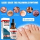 thumbnail image 2 of Solución reparadora de uñas para manos y pies. Cuidado de uñas grises. Solución reparadora para uñas grises., 2 of 3