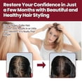 thumbnail image 3 of Hair Growth Treatment Care Regrowth For Women Prevents Hair Loss Scalp Foam, 3 of 5