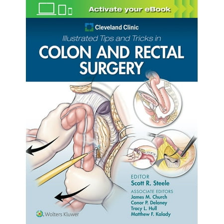 UPC: 9781975108250 | Cleveland Clinic Illustrated Tips and Tricks in Colon and Rectal Surgery (Paperback)