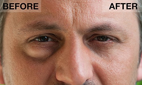 under eye instant tightening cream