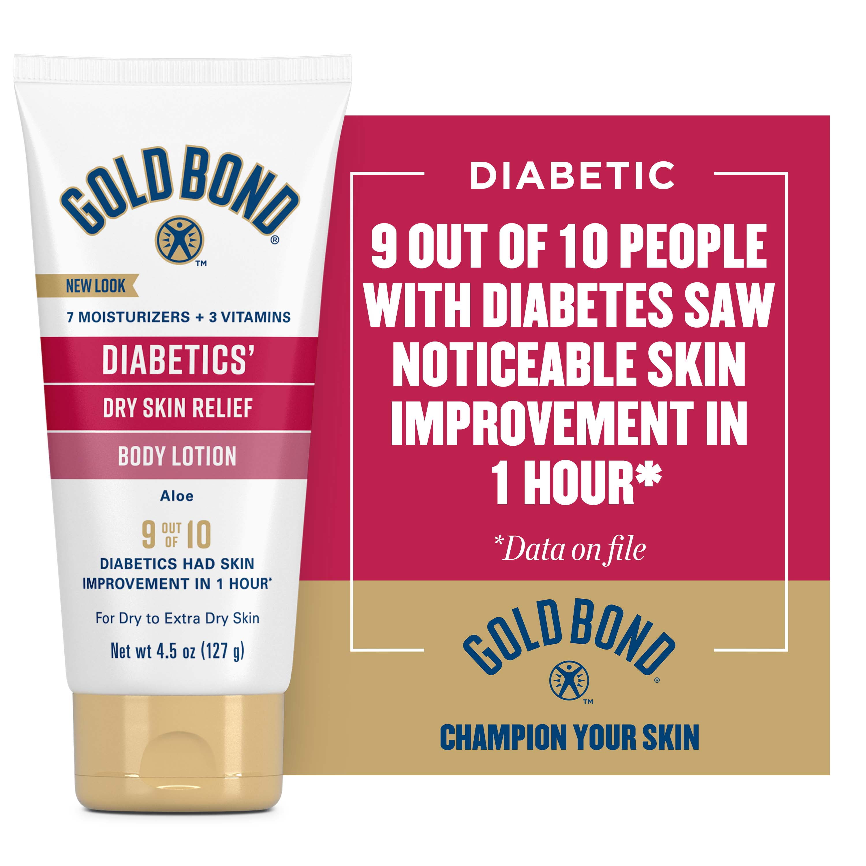 Gold Bond Diabetics' Dry Skin Relief Body Lotion, 4.5 oz., With Aloe