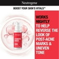 thumbnail image 2 of Neutrogena Stubborn Marks PM Treatment with Retinol SA, 1 fl. oz, 2 of 7