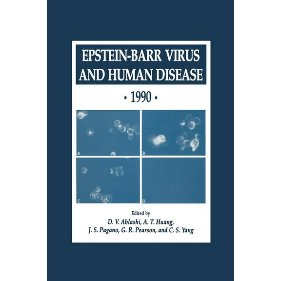Experimental Biology and Medicine Epstein-Barr Virus and Human Disease - 1990, Book 24, (Paperback)