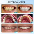 thumbnail image 4 of White Stain Removal Powder Powder Gingiva Fresh Breath Tooth Decay And Clean Teeth Pore Strips, 4 of 8