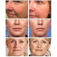 thumbnail image 2 of 5 uds crema de Retinol reafirmante facial crema antienvejecimiento elimina las arrugas líneas finas suero blanqueador hidratante 20g kaili Sencillez, 2 of 5