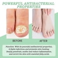 thumbnail image 2 of 1/3/5x Nutraboost Nail Gel,nail Treatments Gel Cream Nail Fungus Removal 20ml, 2 of 5