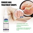 thumbnail image 5 of Repair Hand & Foot Soft Nail Shine Thickening Nail Treatment 75ml, 5 of 5