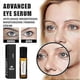 thumbnail image 5 of 2Pcs Rollerball Castor Oil And Frankincense, Frankincense Essential Oil, Castor Oil Roller Ball With Frankincense Under Eye, Reduces Fine LinesAnti-ag, 5 of 5