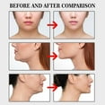 thumbnail image 6 of Invisible Face Lifting Tape - 100 PCS V-Shaped Face Patch, Instant Jawline Tightening & Contouring, Double Chin Reducer, No-Trace Adhesive for Slimmer Look, 6 of 8