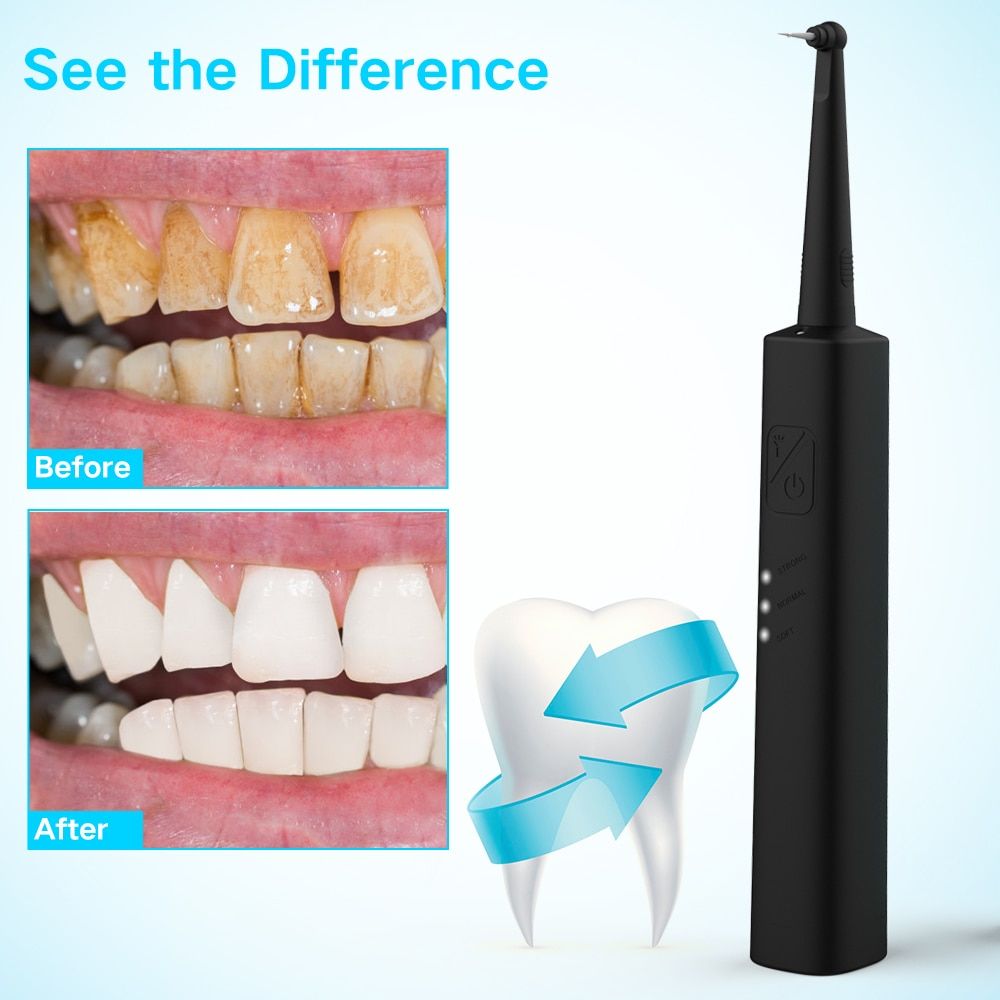 best dental tools for home use