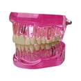 thumbnail image 1 of lionlar Dental Demonstration Teeth Model Observation Practical Removable Study Teach pink, 1 of 9