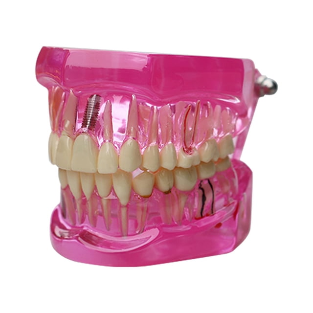 lionlar Dental Demonstration Teeth Model Observation Practical Removable Study Teach pink