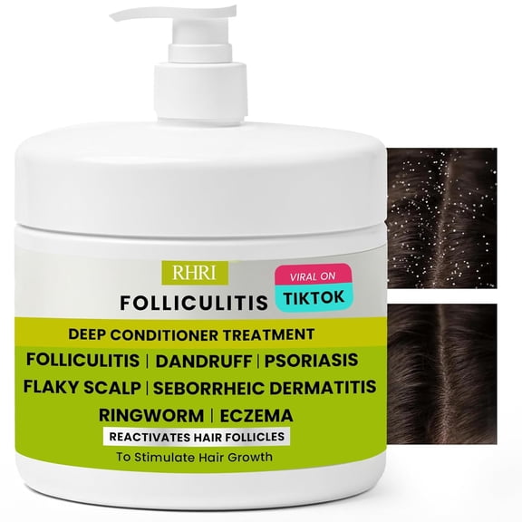 Folliculitis Deep Conditioner | Effective Scalp Treatment for Seborrheic Dermatitis, Psoriasis, Dry Itchy Scalp