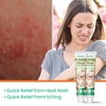 thumbnail image 3 of Prickly Heat Cream Skin Care 30g, 3 of 5