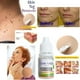 thumbnail image 1 of Líquido para el tratamiento de las verrugas de la verruga de la etiqueta de la piel de 10 ml contra el ungüento del remedio del removedor de lunares, 1 of 8