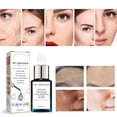 Niacinamide Peptide Facial Collagen Skin Care 30ml Head Suction with Camera Cancer Skin Care