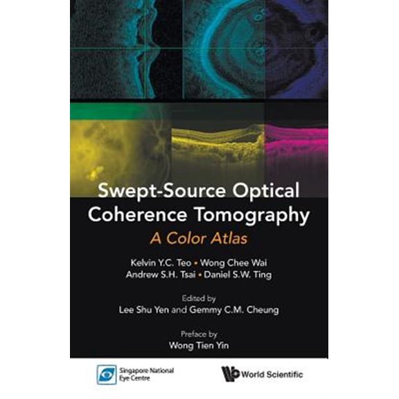 Pre-Owned Swept-source Optical Coherence Tomography: A Color Atlas