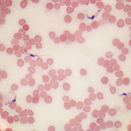 Trypanosoma Gambiense  Smear Microscope Slide price history on PriceWatchPro