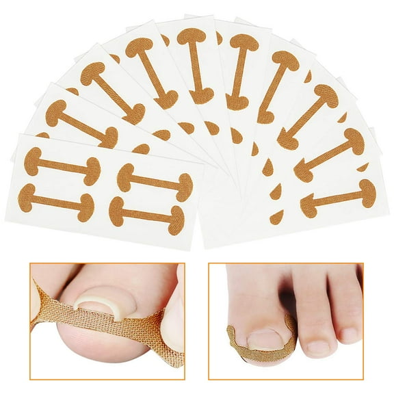 Invisible Wear Ingrown Toenail Treatment Strips, Ergonomic Design For Pain-Free Nail Guidance, Breathable Material Keeping Feet Fresh, Strong Adhesion Ensures Secure Fit,