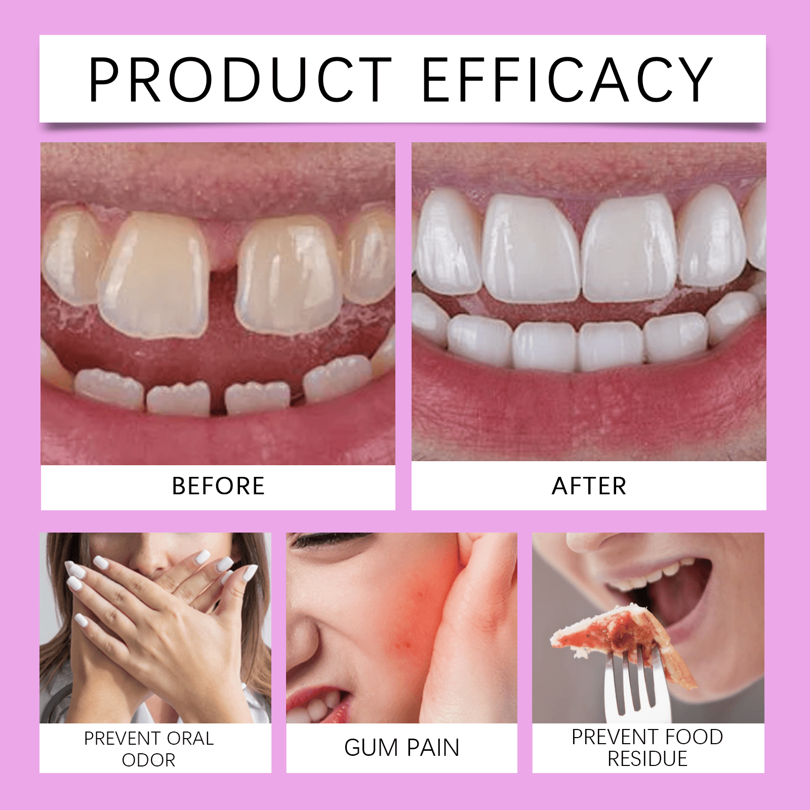Alvantor Thermoplastic Denture Adhesive, Extra Strong Hold Waterproof Secure Grip for Upper Lower Partials, Zinc Free, 0.71oz