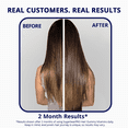 thumbnail image 4 of SugarbearPRO Hair Vitamin Gummies with Biotin, B12, MSM & Omega-3s, Vegan Supplement, 1 Month Supply, 4 of 9