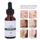 thumbnail image 3 of Esencia De Suero Facial De Té, Hidrata Y Nutre La Piel, Elimina Las Marcas De Acné, 30 Ml, 3 of 7