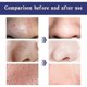 thumbnail image 4 of Jaysuing Deep Pore Cleansing Paste Deep Cleansing Nose Blackhead Closed Mouth Firming Pore Care Nasal Sticker - 6Pcs, 4 of 4