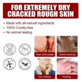 thumbnail image 3 of 5 Pairs Exfoliating Essence Foot Mask Moisturizing Hydrating Remove Dead Skin Skin-friendly, 3 of 5