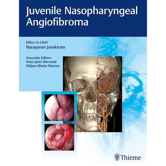 Juvenile Nasopharyngeal Angiofibroma, (Hardcover)