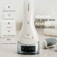 thumbnail image 4 of PRITECH Electric Foot Callus Remover Tool, Electric Pedicure Foot File, Rechargeable Callus Removers Kit Extra Thick, Heel, Hand, Skin Gift(White), 4 of 8