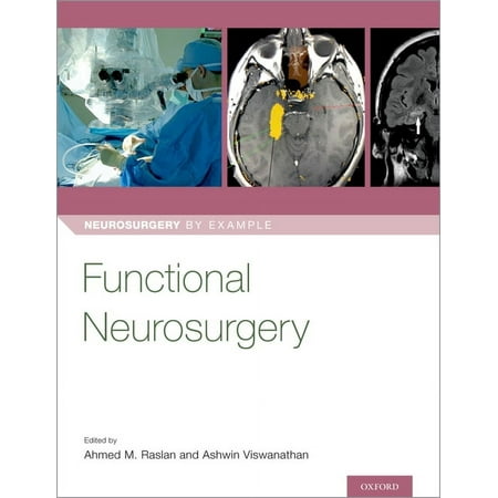 UPC: 9780190887629 | Neurosurgery by Example: Functional Neurosurgery (Paperback)