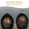 thumbnail image 3 of Viviscal Men's Hair Growth Supplements for Thicker Fuller Hair, Clinically Proven Collagen Complex, 60 Tablets 1 Month Supply, 3 of 8