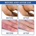 thumbnail image 5 of 1/2/3Pcs 30g Chilblain Cream Anti-cracking Frostbite Moisturiser Deep Nourishing, 5 of 5