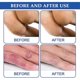 thumbnail image 5 of 1/2/3Pcs 30g Chilblain Cream Anti-cracking Frostbite Moisturiser Deep Nourishing, 5 of 5