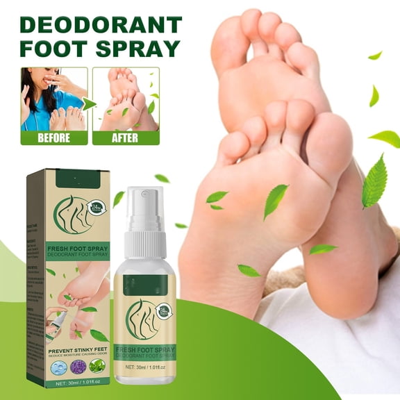 Tkrady Fresh Foot Deodorant Spray, Stinky Feet, Reduce Causing Odor 30ml