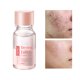 thumbnail image 4 of Loción secante salicílica Essence Atenúa las marcas Mejora la condición Control de grasa Cuidado suave para pieles sensibles 10 ml a essence, 4 of 9