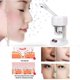 thumbnail image 2 of Ionic Spraying Machine, Ozone Vapor Skin Care Machine, Advanced Facial Steam For SPA Salon And Moisturizing Face To Face Cleansing, 2 of 9