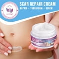 thumbnail image 3 of Scar Repair Cream for Old & New Scars – Helps Improve Appearance from Cuts, Stretch Marks, C-Sections & Surgeries, 1.7 oz, 3 of 10
