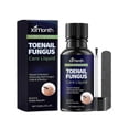thumbnail image 1 of Toenail Fungus Treatment Extra Strength, Nail Fungus Treatment for Toenail, Fungus Nail Treatment, Gentle Nail Fungus Treatment for Fingernails, 1 of 5