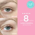 thumbnail image 3 of GUGUG Limpiador de piel Espátula facial Espátula para la piel Limpiador de poros Herramientas removedoras de espinillas para limpieza facial profunda-4 modos Rosa, 3 of 5