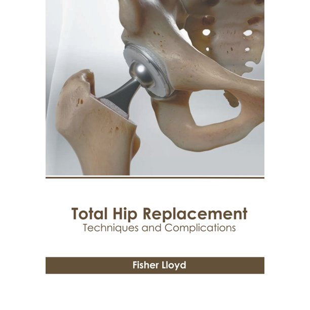 Total Hip Replacement Techniques and Complications (Hardcover