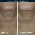 thumbnail image 6 of RoC Skincare DERM CORREXION® Contour Cream 1.7 oz, 6 of 11