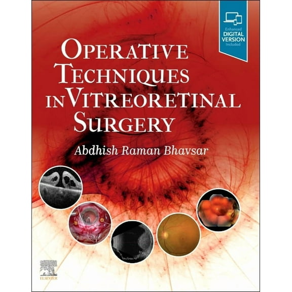 Operative Techniques in Vitreoretinal Surgery, (Hardcover)