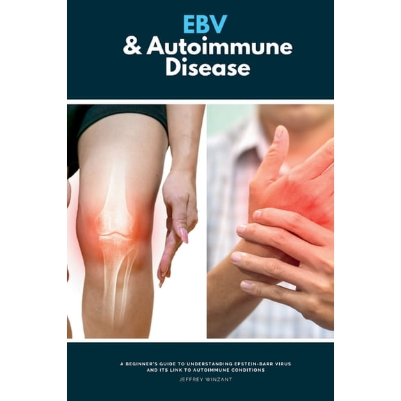 EBV & Autoimmune Disease: A Beginner's Guide to Understanding Epstein-Barr Virus and Its Link to Autoimmune Conditions, (Paperback)