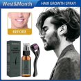 thumbnail image 1 of West&Month Beard Growth Spray Set Nourishing Moisturizing Spray Beard Care Beard Long Thick Liquid, 1 of 5