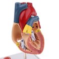 thumbnail image 3 of 1: 1 Modelo Estrutura de Sistema Corazones Patológico Trombo de 4 Juguete Educativo Escolar Sunnimix Estatua del corazón humano, 3 of 8